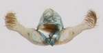Male genitalia; North Carolina; J.B. Sullivan.