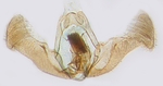 Male genitalia; North Carolina; J.B. Sullivan. 