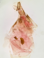 Female genitalia; Madison County; Jim Petranka.