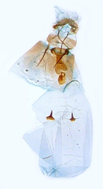 Female genitalia; North Carolina; J.B. Sullivan.