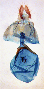 Female genitalia; Carteret County; J.B. Sullivan.
