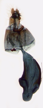 Female genitalia; Yancey County; J.B. Sullivan.
