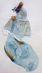 Female genitalia; Jones County; J.B. Sullivan.