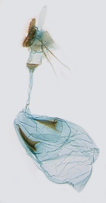 Female genitalia; Jones County; J.B. Sullivan.