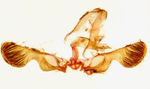 Male genitalia; Cumberland County; Jim Petranka. 