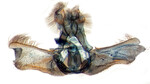 male genitalia; Madison Co.; J.B. Sullivan