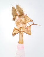 Female genitalia; Madison County; Jim Petranka.