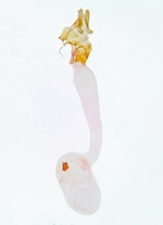 Female genitalia; Henderson County; Jim Petranka.