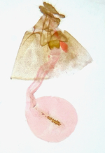 Female genitalia; Madison County; Jim Petranka.