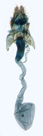 Female genitalia; North Carolina; J.B. Sullivan