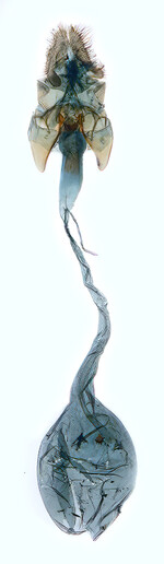 Female genitalia; North Carolina; J.B. Sullivan