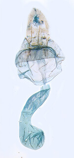 Female genitalia; Ashe Co.; J.B. Sullivan