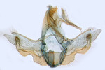 Male genitalia; Ashe Co.; J.B. Sullivan