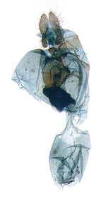 Female genitalia; Ashe Co.; J.B. Sullivan