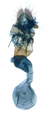 Female genitalia; Ashe Co.; J.B. Sullivan