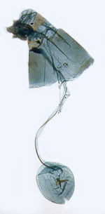 Female genitalia; North Carolina; J.B. Sullivan.