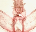 Male genitalia; Richmond County; Jim Petranka.