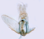 Male genitalia; North Carolina; J.B. Sullivan.