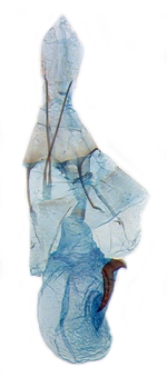 Female genitalia; Cabarrus County; J.B. Sullivan.