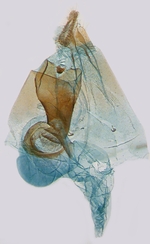 Female genitalia; North Carolina; J.B. Sullivan. 