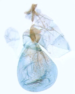 Female genitalia; Carteret County; J.B. Sullivan.