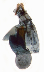 Female genitalia; Madison County; J.B. Sullivan.