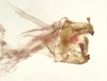 Male genitalia; Cumberland County; Jim Petranka. 