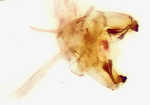 Male genitalia; Cumberland County; Jim Petranka. 