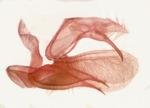 Male genitalia (lateral view); Madison County; Jim Petranka.
