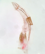 Female genitalia (in situ); Craven County; Jim Petranka.
