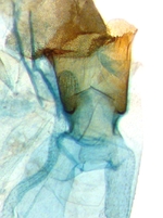 Female ostial area; North Carolina; J.B. Sullivan. 