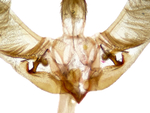 Male genitalia; Rowan County; Jim Petranka.