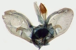 Male genitalia; North Carolina; J.B. Sullivan.