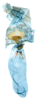 Female genitalia; North Carolina; J.B. Sullivan.