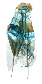 Female genitalia; North Carolina; J.B. Sullivan.