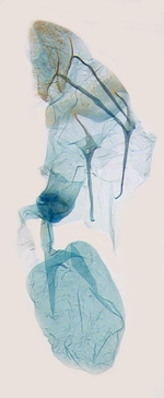 Female genitalia; North Carolina; J.B. Sullivan.