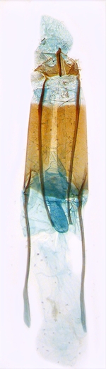 Female genitalia; North Carolina; J.B. Sullivan.