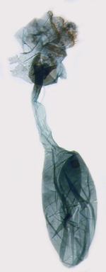Female genitalia; North Carolina; J.B. Sullivan.
