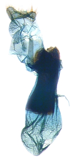 Female genitalia; North Carolina; J.B. Sullivan.