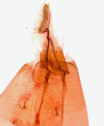 Female genitalia; Richmond County; Jim Petranka.