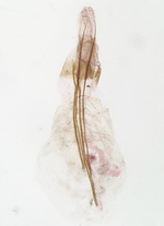 Female genitalia; Orange County; Jim Petranka.