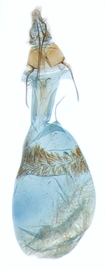 Female genitalia; North Carolina; J.B. Sullivan.