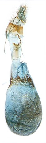 Female genitalia; North Carolina; J.B. Sullivan.