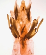 Male genitalia (with abdominal scales); Henderson County; Jim Petranka.