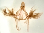 Male genitalia; Henderson County; Jim Petranka.