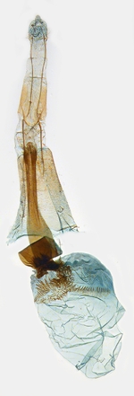 Female genitalia; North Carolina; J.B. Sullivan.