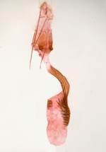 Female genitalia; Moore County; Jim Petranka.