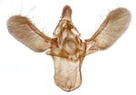 Male genitalia; Brunswick County; Jim Petranka.