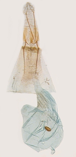 Female genitalia; North Carolina; J.B. Sullivan.