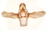 Male genitalia; Henderson County; Jim Petranka.
